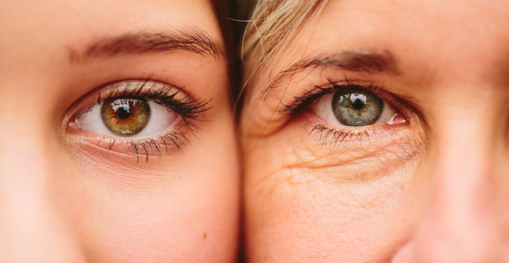 Best Treatments for Dark Circle Under Eyes in Sydney