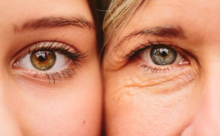 Dark Circle Under-Eye Treatments in Sydney