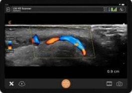 Why Aesthetic Ultrasound Is an Important Tool in Consultations