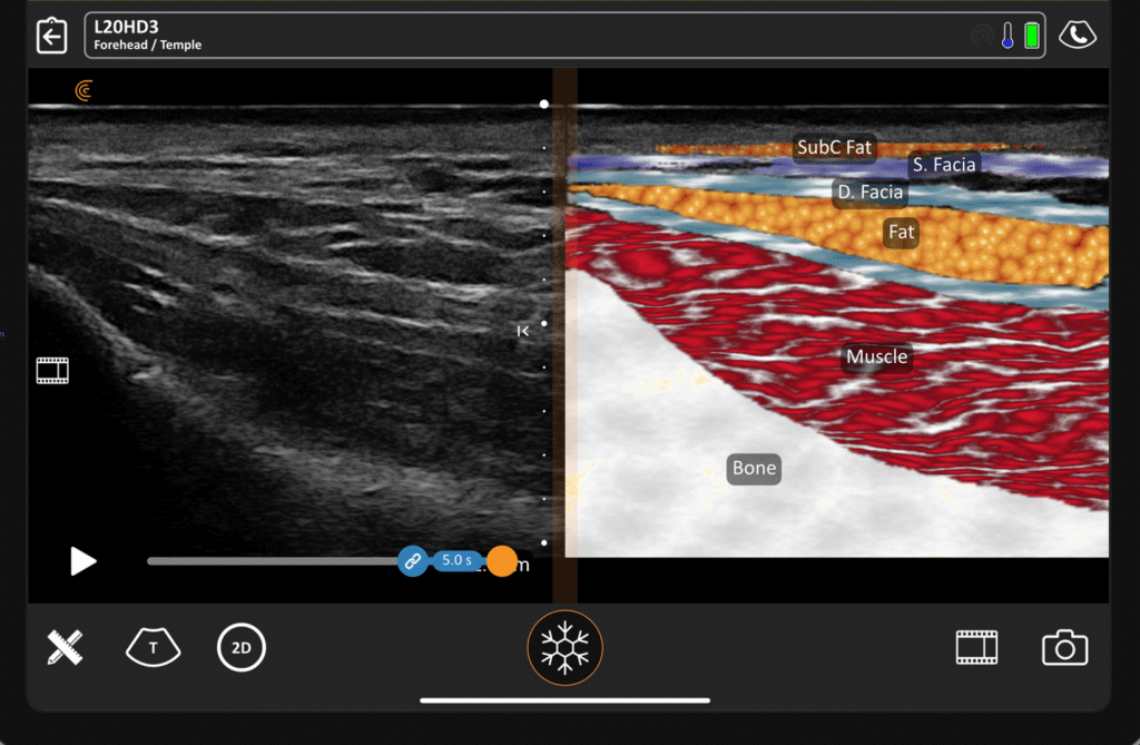 Ultrasound Image Showing Detailed Facial Anatomy